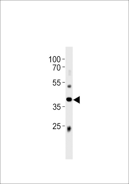 ABI3 Antibody in Western Blot (WB)