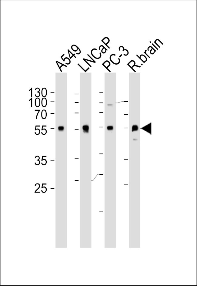 alpha-1D Adrenoceptor Antibody in Western Blot (WB)