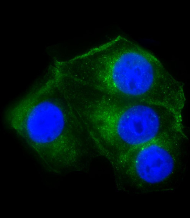 Cathepsin D Antibody in Immunocytochemistry (ICC/IF)