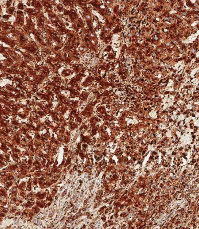 Cathepsin D Antibody in Immunohistochemistry (Paraffin) (IHC (P))