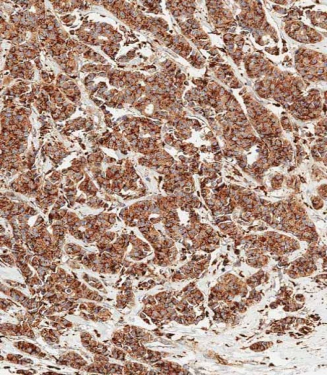 Cathepsin D Antibody in Immunohistochemistry (Paraffin) (IHC (P))