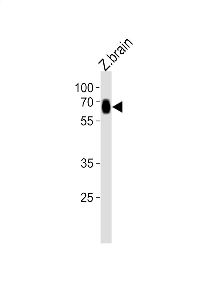 SLC17A6A Antibody in Western Blot (WB)