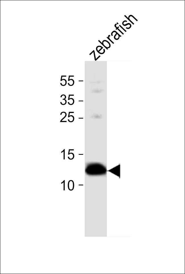 BA1 Antibody in Western Blot (WB)