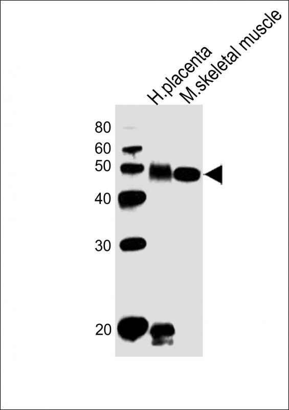 DLK1 Antibody in Western Blot (WB)