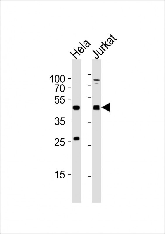 AVPR2 Antibody in Western Blot (WB)