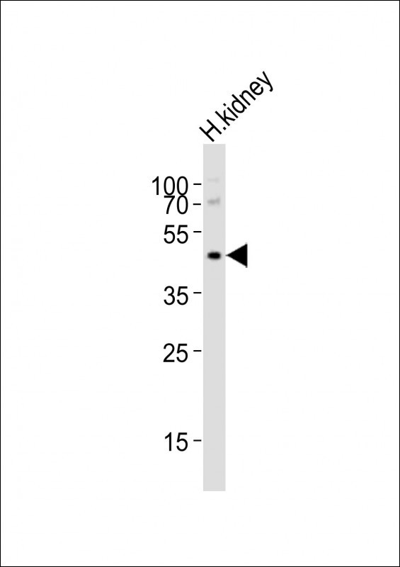 NPY2R Antibody in Western Blot (WB)