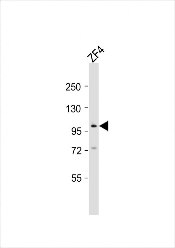 ATG9A Antibody in Western Blot (WB)