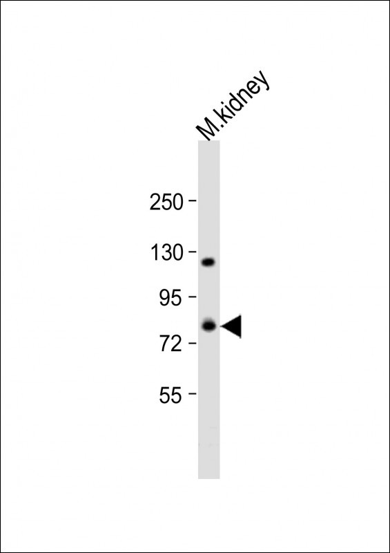 ADAM21 Antibody in Western Blot (WB)