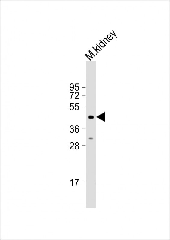 ACP6 Antibody in Western Blot (WB)