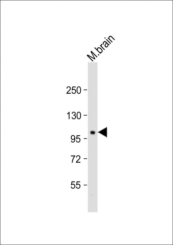 PI4KA Antibody in Western Blot (WB)