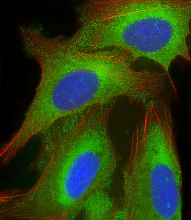 EEF1A1P5 Antibody in Immunocytochemistry (ICC/IF)