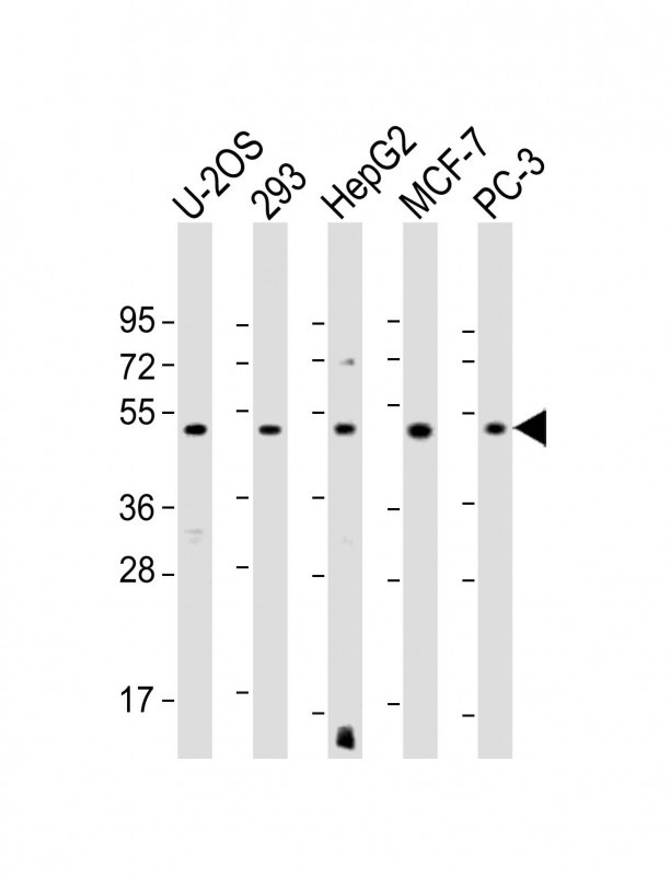 EEF1A1P5 Antibody in Western Blot (WB)