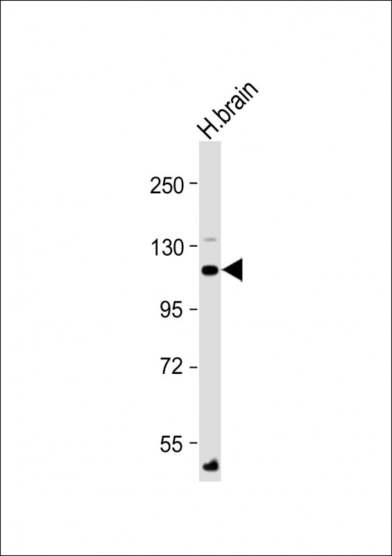 ATP1A4 Antibody in Western Blot (WB)