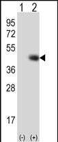 TPST1 Antibody in Western Blot (WB)