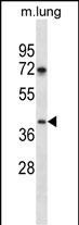 TPST1 Antibody in Western Blot (WB)