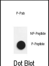 Phospho-Nephrin (Tyr1193) Antibody in Dot Blot (DB)