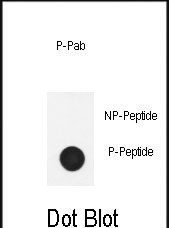 Phospho-Nephrin (Tyr1210) Antibody in Dot Blot (DB)