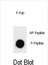 Phospho-AMOT (Ser1041) Antibody in Dot Blot (DB)