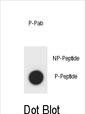Phospho-AMOT (Tyr599) Antibody in Dot Blot (DB)