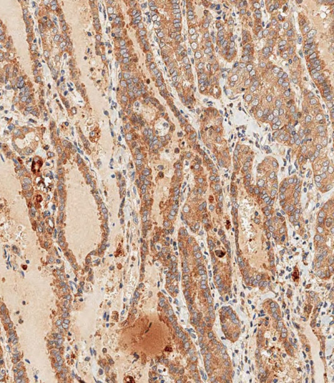 WNT5A Antibody in Immunohistochemistry (Paraffin) (IHC (P))