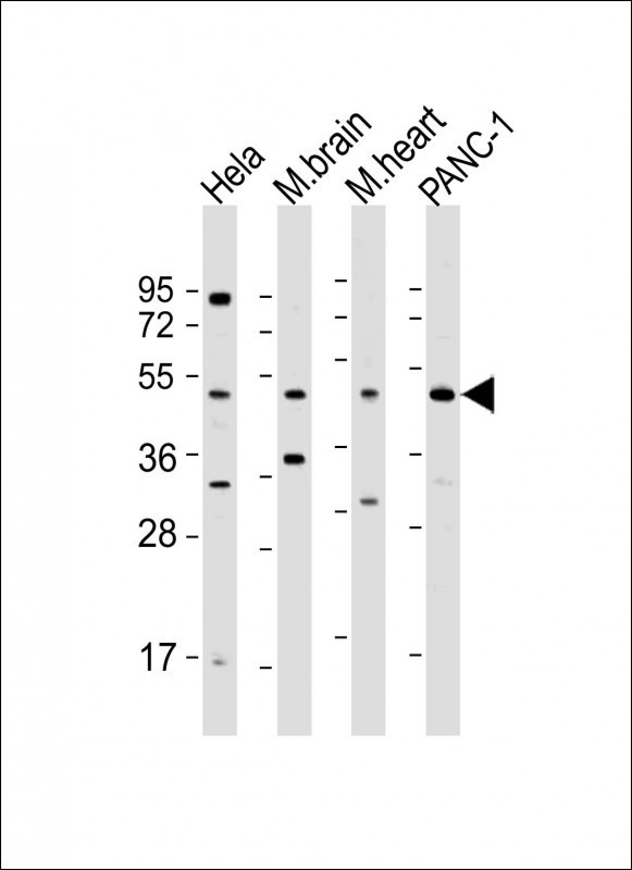 WNT5A Antibody in Western Blot (WB)