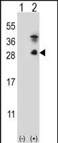 Kallikrein 7 Antibody in Western Blot (WB)