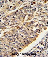 Cathepsin E Antibody in Immunohistochemistry (Paraffin) (IHC (P))