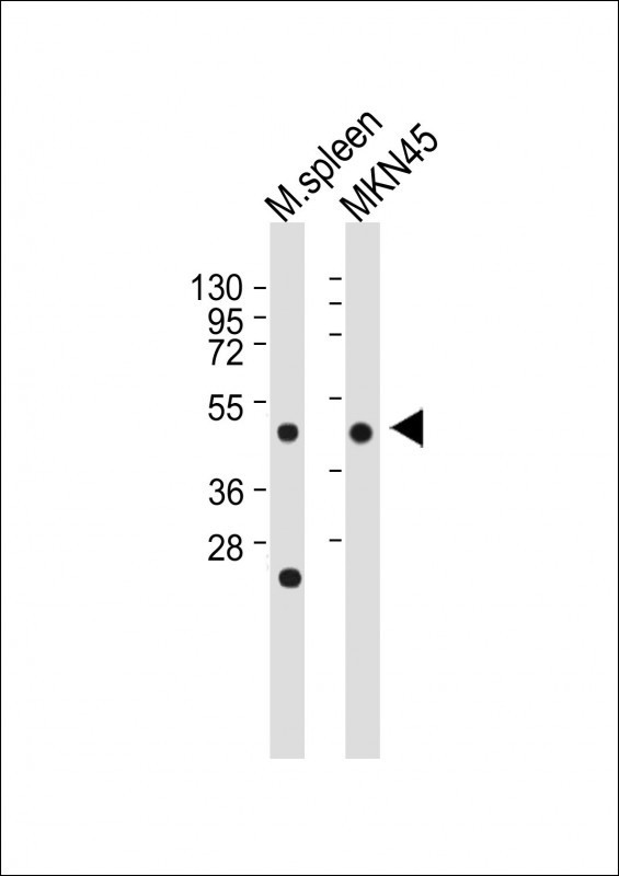 Cathepsin E Antibody in Western Blot (WB)