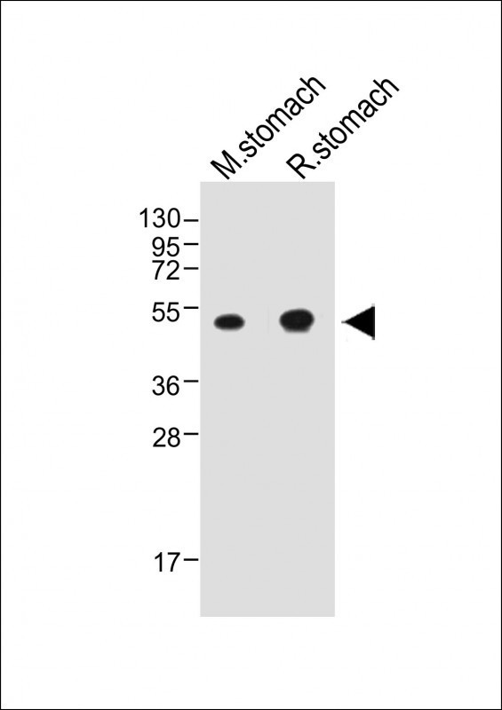 Cathepsin E Antibody in Western Blot (WB)