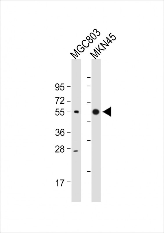 Cathepsin E Antibody in Western Blot (WB)