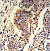 KYNU Antibody in Immunohistochemistry (Paraffin) (IHC (P))