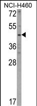 KYNU Antibody in Western Blot (WB)