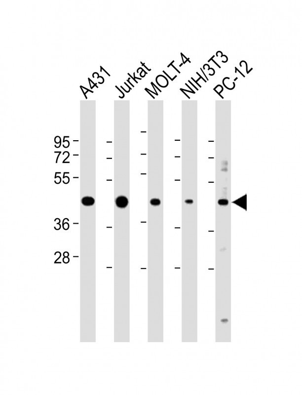 ASS1 Antibody in Western Blot (WB)