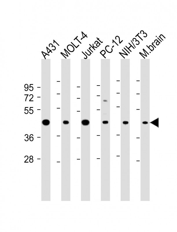 ASS1 Antibody in Western Blot (WB)