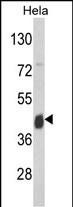 ASS1 Antibody in Western Blot (WB)