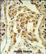 ESPN Antibody in Immunohistochemistry (Paraffin) (IHC (P))