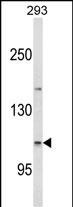 ESPN Antibody in Western Blot (WB)