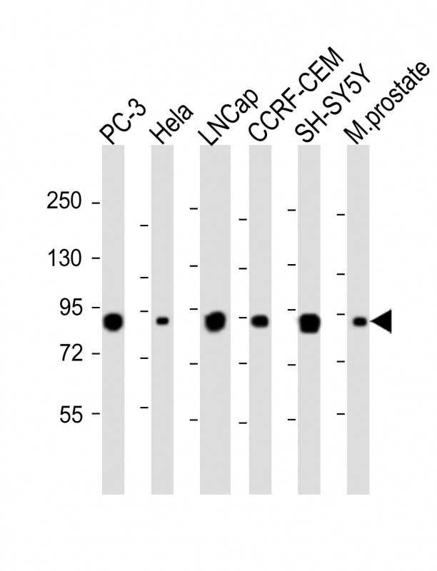 TGM4 Antibody in Western Blot (WB)