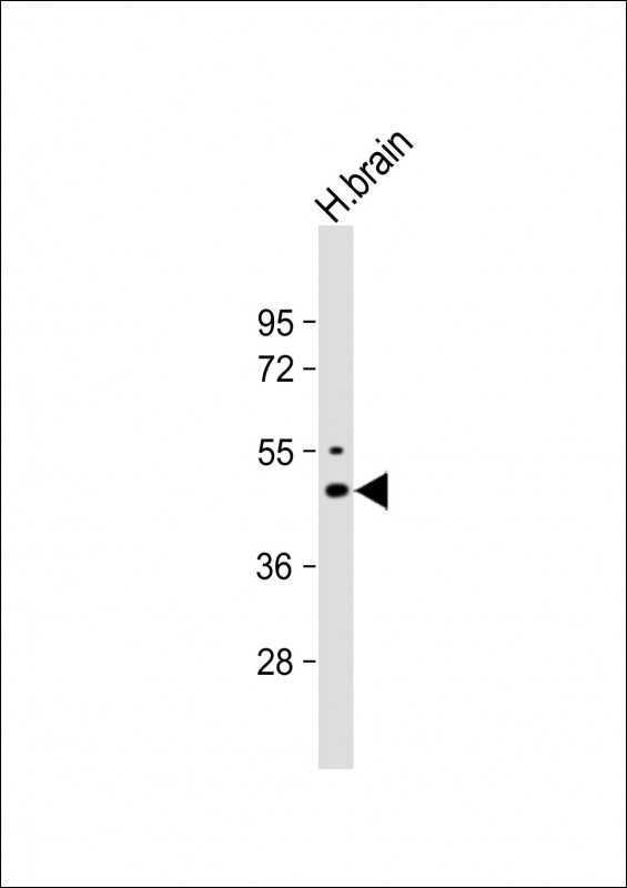 Kir2.1 (KCNJ2) Antibody in Western Blot (WB)