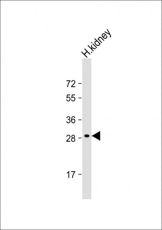 DIO1 Antibody in Western Blot (WB)