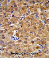 CBS Antibody in Immunohistochemistry (Paraffin) (IHC (P))