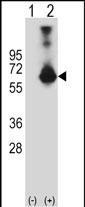 CBS Antibody in Western Blot (WB)