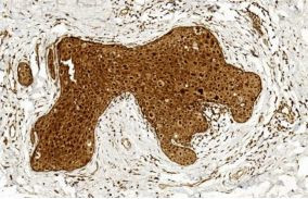 BCOR Antibody in Immunohistochemistry (Paraffin) (IHC (P))