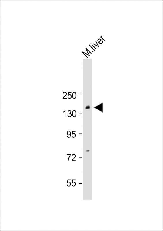 BCOR Antibody in Western Blot (WB)