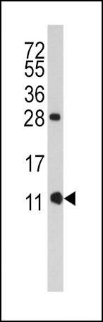 FKBP1B Antibody in Western Blot (WB)