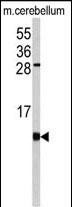 FKBP1B Antibody in Western Blot (WB)