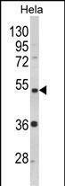 PPP2R2B Antibody in Western Blot (WB)