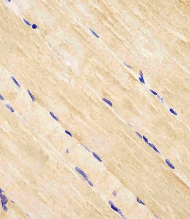 RAB7A Antibody in Immunohistochemistry (Paraffin) (IHC (P))