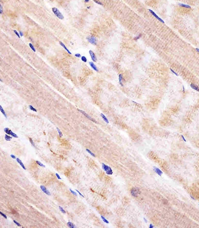 RAB7A Antibody in Immunohistochemistry (Paraffin) (IHC (P))