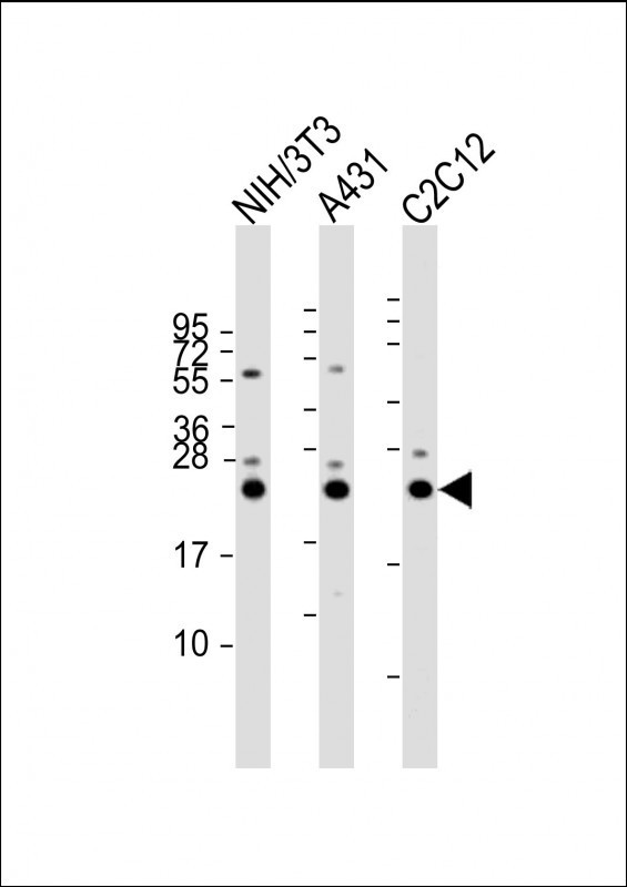 RAB7A Antibody in Western Blot (WB)